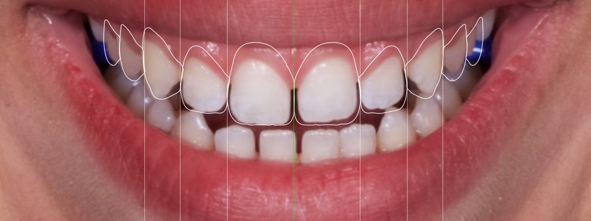 Design do Sorriso